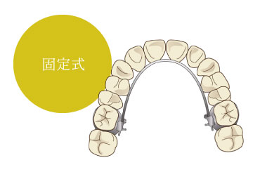 拡大床