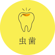 虫歯